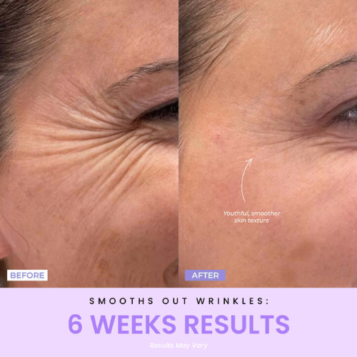 SulmiĀ® LED Facial Facelift Tool