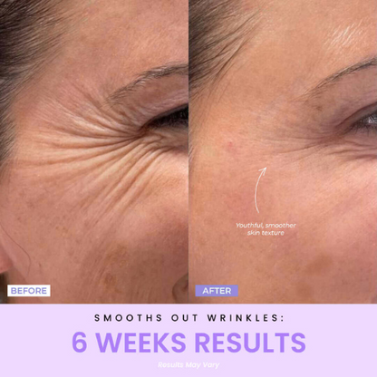 Sulmi®  LED Facial Facelift Tool