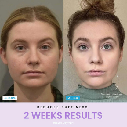 Sulmi®  LED Facial Facelift Tool